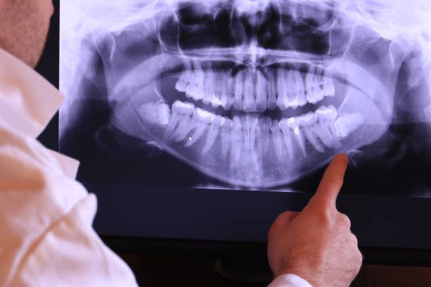 Best Emergency Care for Gum Disease in Pocahontas, IA