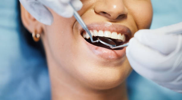 Best Emergency Cosmetic Dentistry (e.g., broken veneers) in Pocahontas, IA